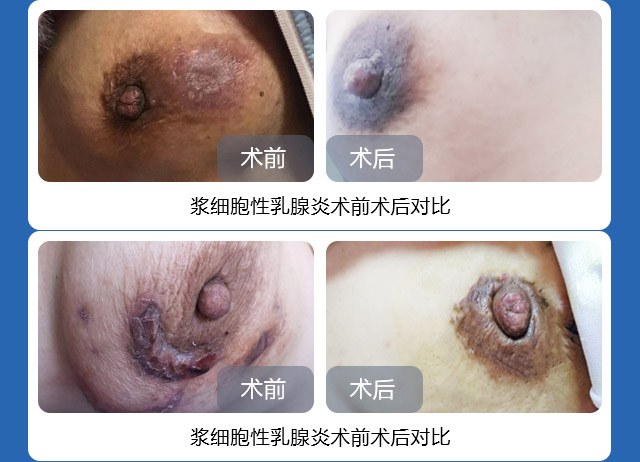 ��ǧ�������������ǻ�����Ч�õĳ�ŵ