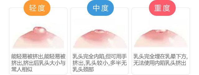 ʲô����ͷ����