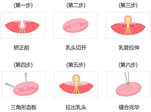 ��ͷ���ݽ�������