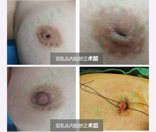 ����������Ч���Ա�